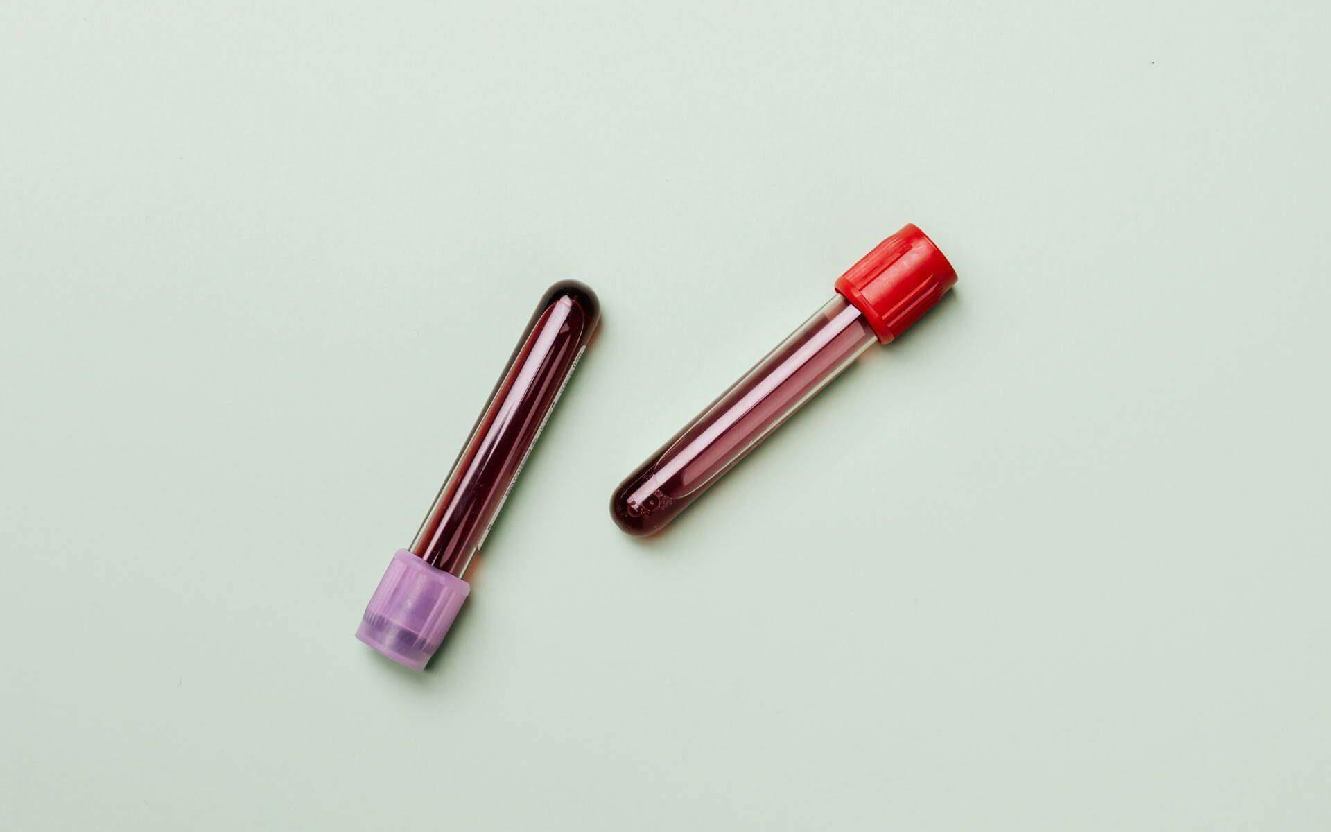 Trombocitoza i tromboza